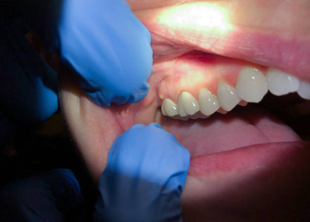 Reliable NJ Emergency Dental Service Solutions